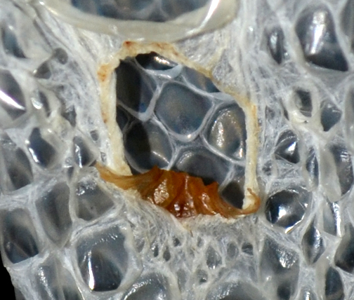 Male Or Female Sperm Pluggs Or Not-6350