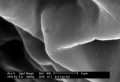 Bp Eye Cap Under Electron Microscope