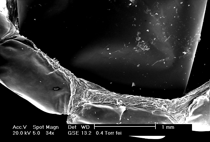 Bp Eye Cap Under Electron Microscope