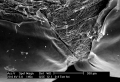 Bp Eye Cap Under Electron Microscope