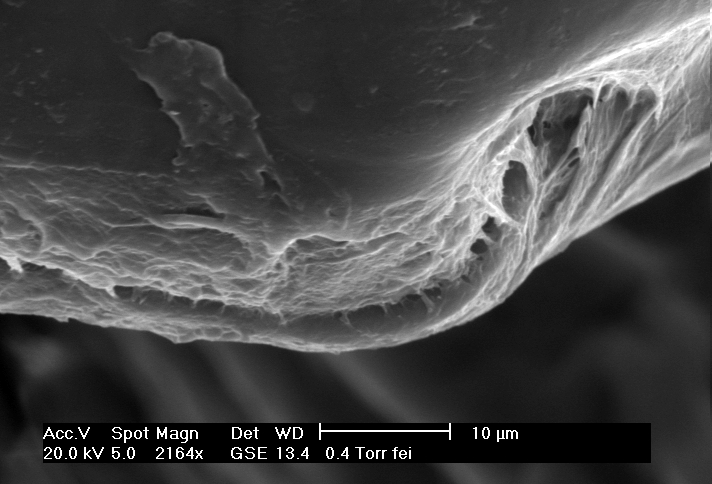 Bp Scales Under Electron Microscope