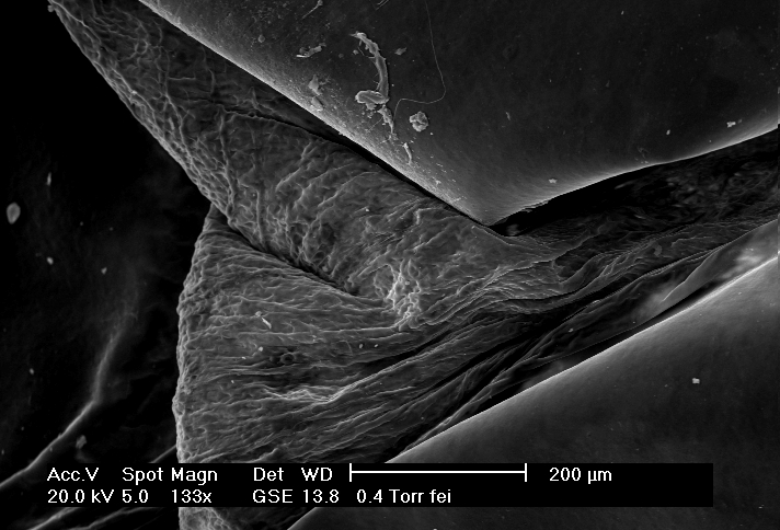 Bp Snake Scales Under Electron Microscope