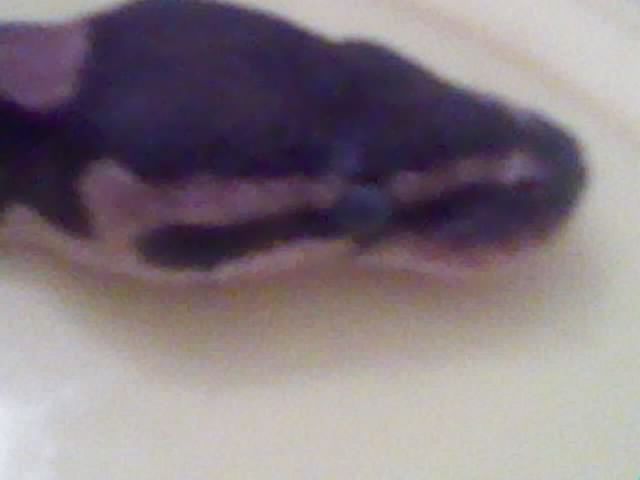 My Bp Kinky