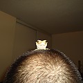 gecko on head