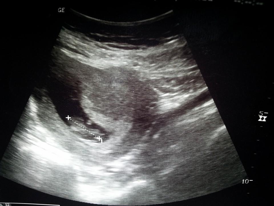 our baby