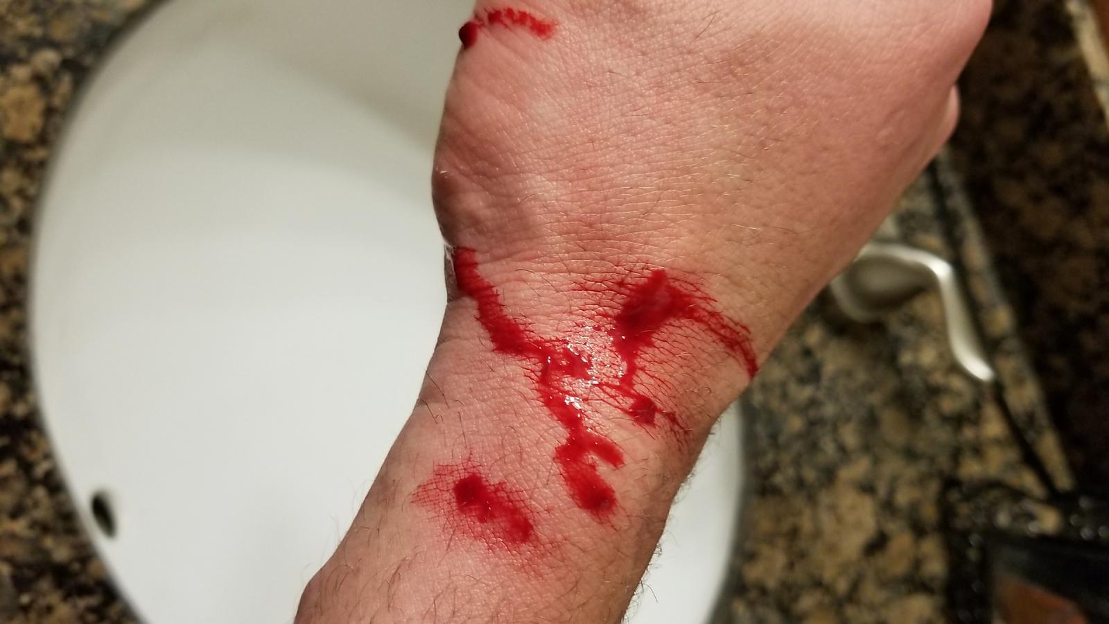 Blood Bite