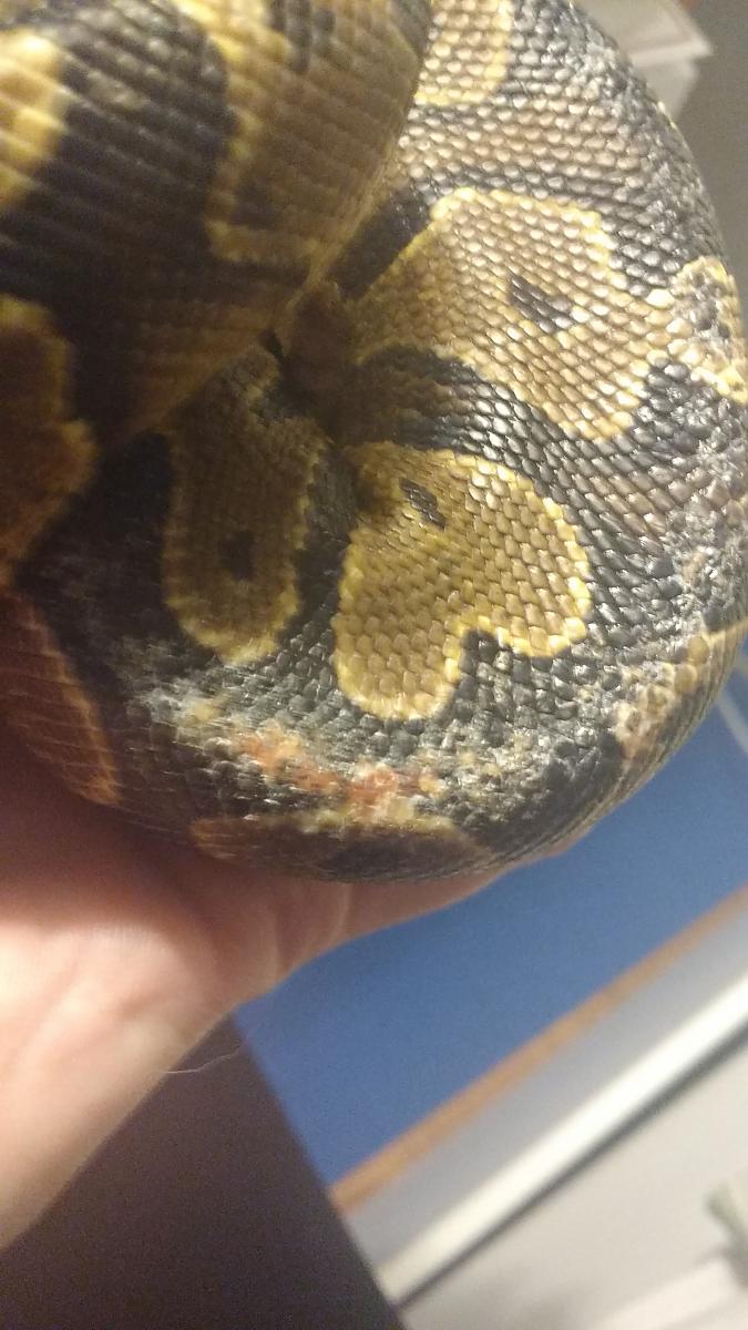 Skin issue