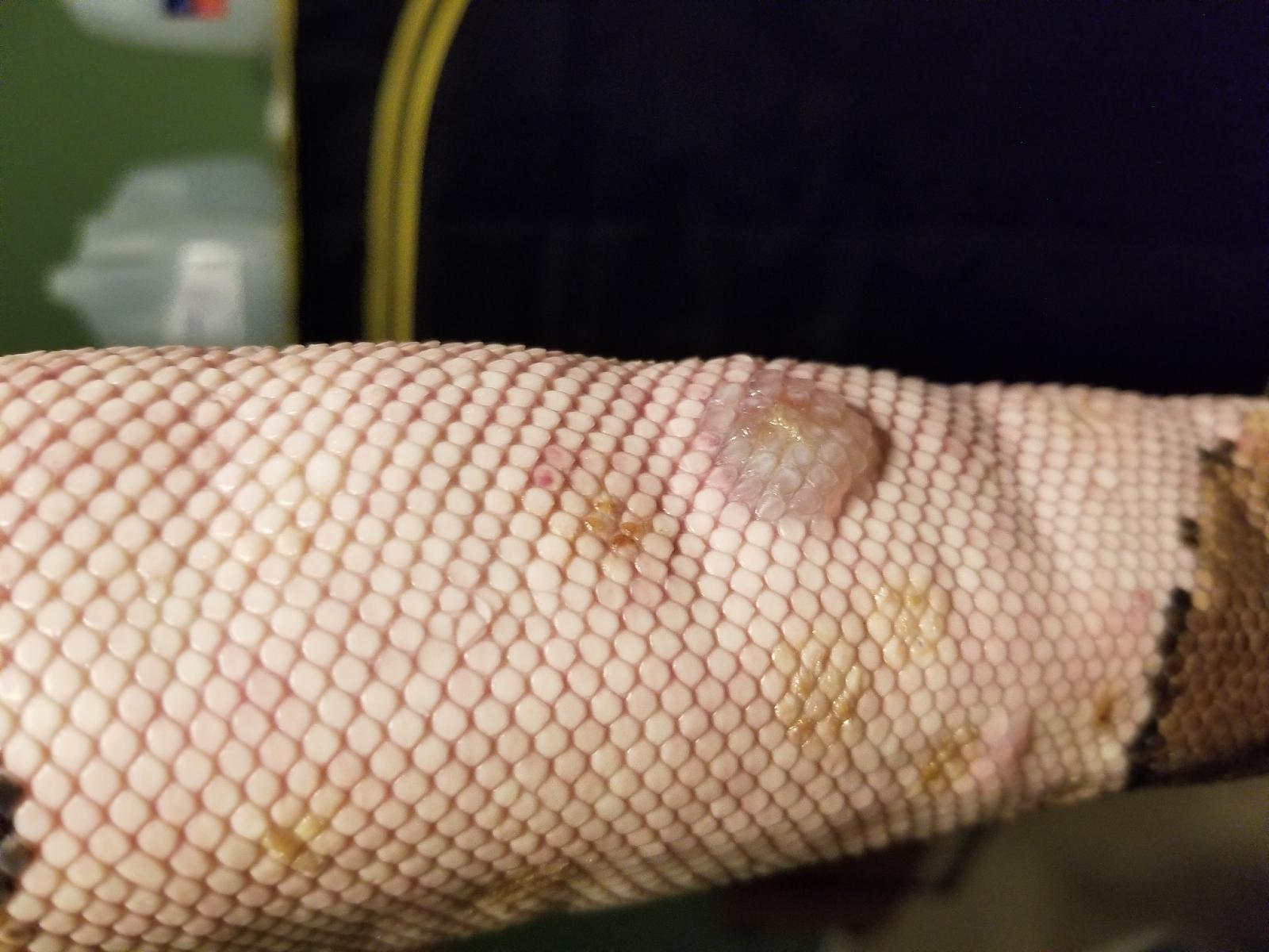 Blister