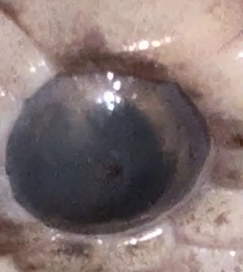 Better Eye
