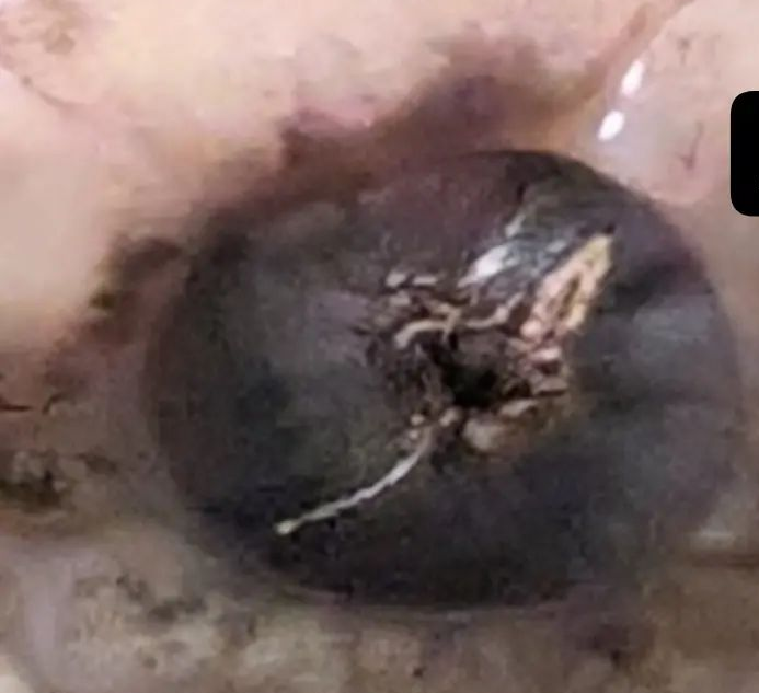 Bad Eye