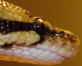 Right Side Smile