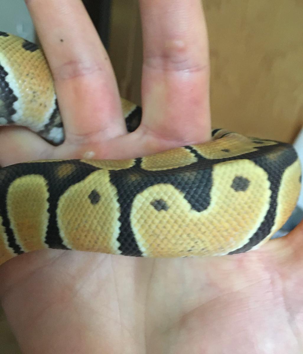 bp on vertical hand